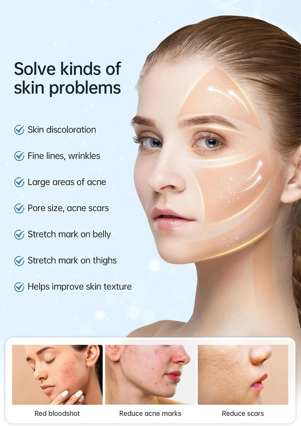 New Hydra Pen H5 Infusion Carrier Serum EMS dan Microneedling Aplikasi Otomatis 4