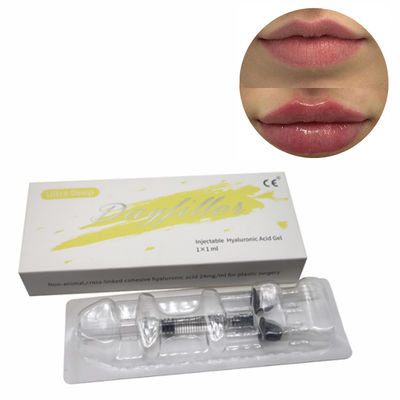 CE Singfiller Deep Hyaluronic Acid Injection Dermal Filler untuk Implan Bedah Plastik